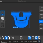 Tomografia CBCT szczęki i żuchwy