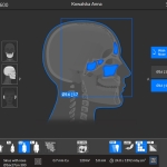 Tomografia CBCT zatok