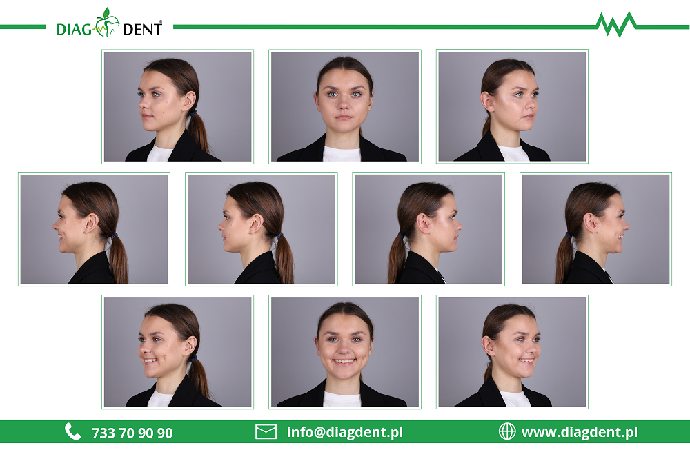 Protokół fotograficzny – przykład zdjęć stomatologicznych